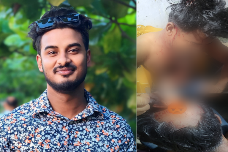 নন্দীগ্রামে প্রকাশ্যে মা.দ.ক সেবনে বাধা দেওয়ায় সাংবাদিকের ওপর হা.ম.লা